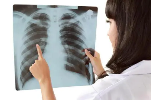 La frattura delle costole